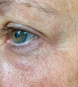 Hyaluronique Serum