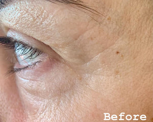 Hyaluronique Serum
