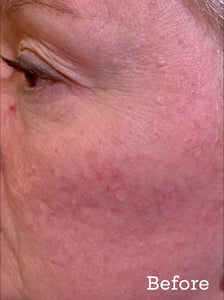 Hyaluronique Serum