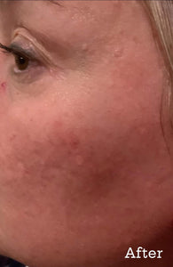 Hyaluronique Serum