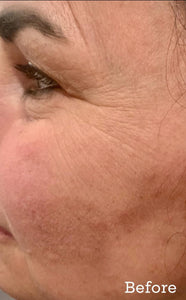 Hyaluronique Serum