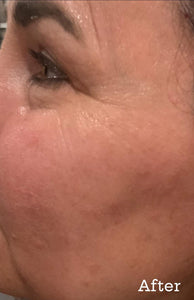 Hyaluronique Serum