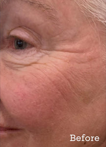 Hyaluronique Serum
