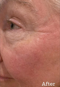 Hyaluronique Serum