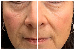 Elixir- Vitamin C Treatment