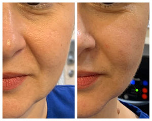 Elixir- Vitamin C Treatment